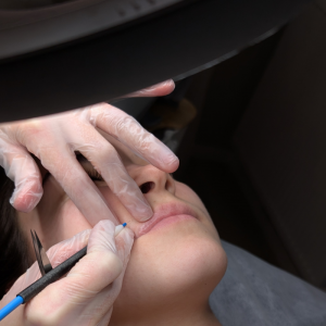 electrolyse seignosse, capbreton, hossegor